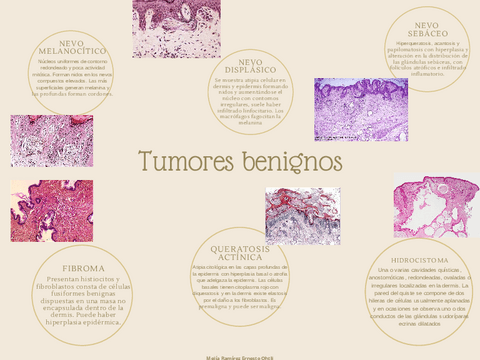 Neoplasias-en-Dermatologia.pdf