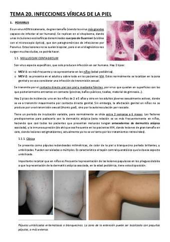 TEMA-20.-INFECCIONES-VIRICAS-DE-LA-PIEL.pdf
