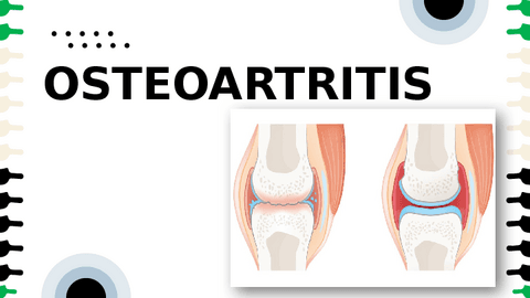 OSTEOARTRITIS.pdf