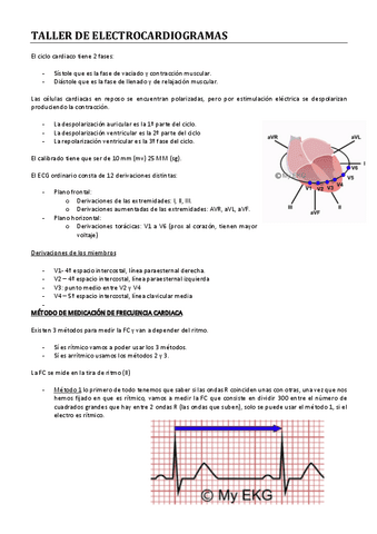 TALLER-DE-ELECTROCARDIOGRAMAS.pdf
