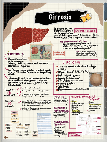 CIRROSIS.pdf