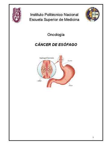 Cancer-de-esofago.pdf