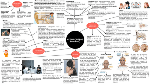 Hipoacusias.pdf