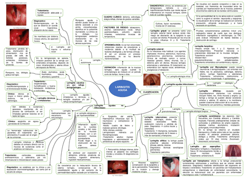 Laringitis-aguda.pdf