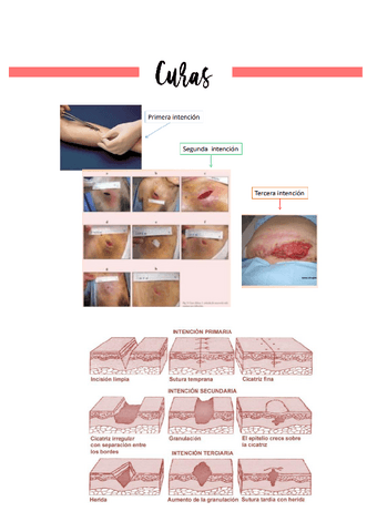 Tema-2.2.2.5-Curas.pdf