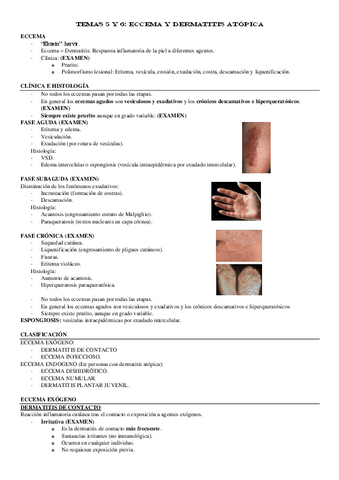 TEMAS-5-y-6-Eccema-y-dermatitis-atopica.pdf