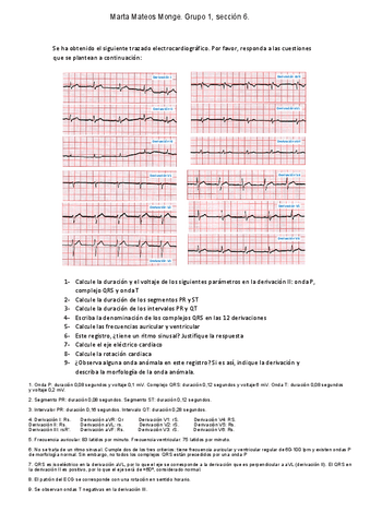 Practica-1-ECG.pdf