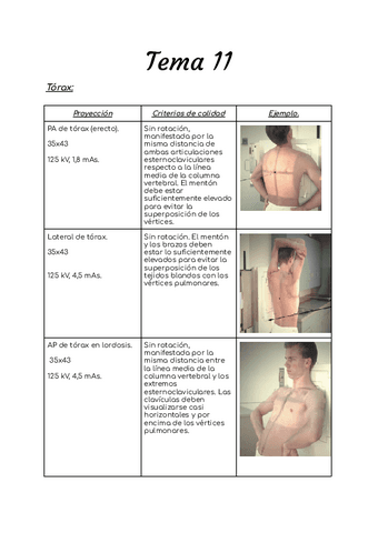 Tema-11-radiologia-simple.pdf