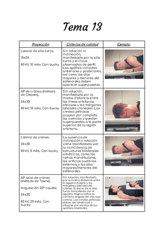 Tema-13-radiologia-simple.pdf