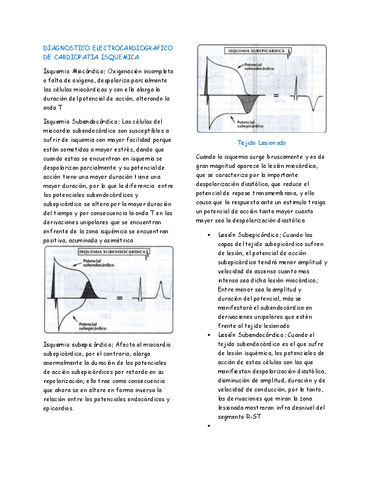 Electrocardiografia-PT-4.-Emiliano-Vega-Ornelas.pdf