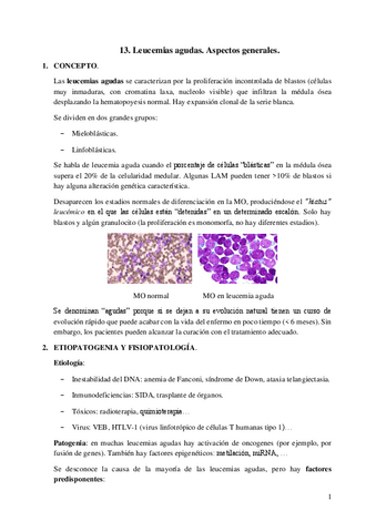 13.-Leucemias-agudas.-Aspectos-generales.pdf