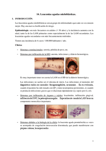 14.-Leucemias-agudas-mieloblasticas.pdf