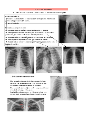 interpretar-radiografia-de-torax.pdf