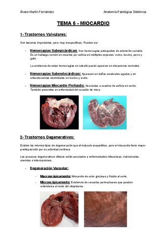 TEMA-6-MIOCARDIO.pdf