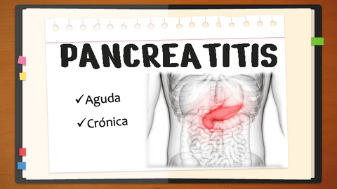 PANCREATITIS-AGUDA-Y-CRONICA..pdf