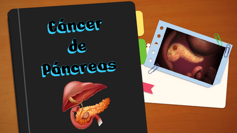 CANCER-DE-PANCREAS.pdf
