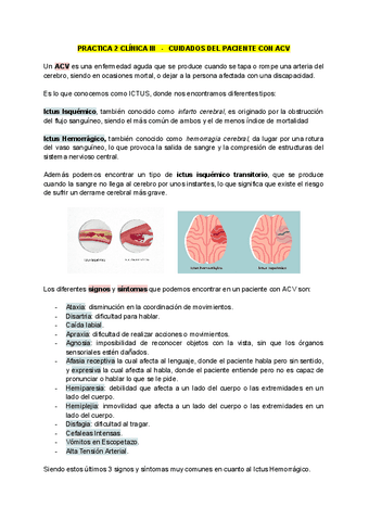 Practica-2-Cuidados-de-Pacientes-con-ACV.pdf