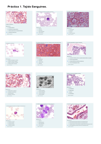 Práctica 1. Cuestionario Tejido Sanguíneo.pdf