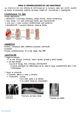 Tema-2.-generalidades de las fracturas.pdf