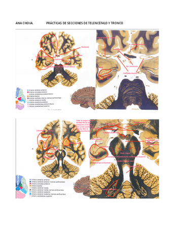 Practica-de-cortes-de-encefalo-y-telencefalo.pdf