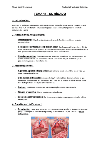 TEMA-11-EL-HIGADO.pdf