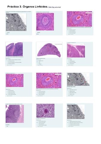 Práctica 3. Cuestionario Órganos Linfoides.pdf