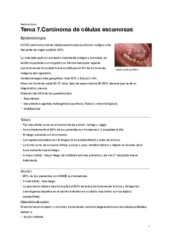Tema-7.-Carcinoma-De-Celulas-Escamosas.pdf