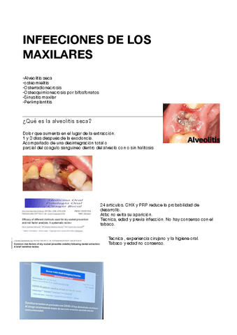 Tema-20.-Infecciones-maxilares.pdf