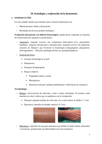 34.-Semiologia-y-exploracion-de-la-hemostasia.pdf