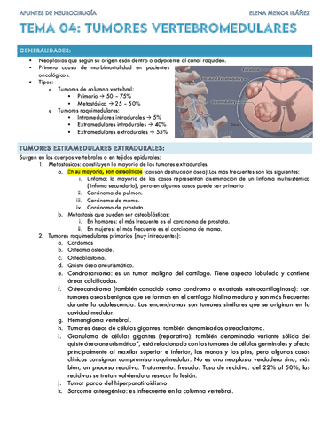 Tumores-Vertebromedulares.pdf