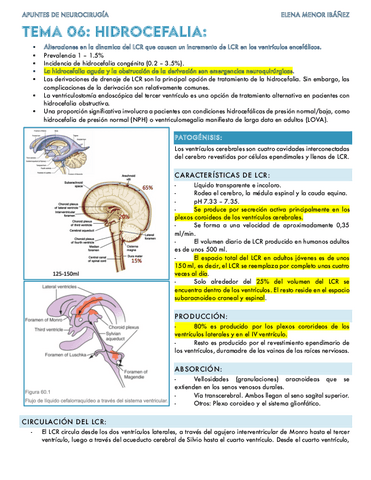 Hidrocefalia.pdf