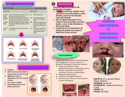 LABIO-LEPORINO-PALADAR-HINDIDO.pdf