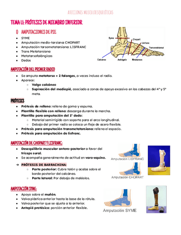 Tema 1: Protesis MI y MS.pdf