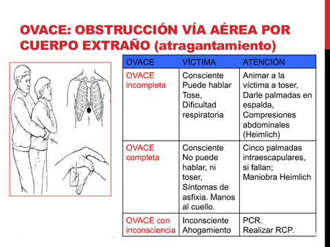 obstruccion-via-aerea.pdf