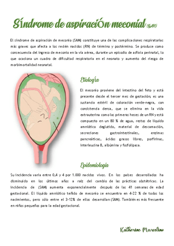 Aspiracion-de-meconio.pdf