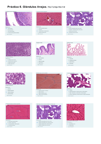Práctica 6. Cuestionario Glándulas Anejas.pdf