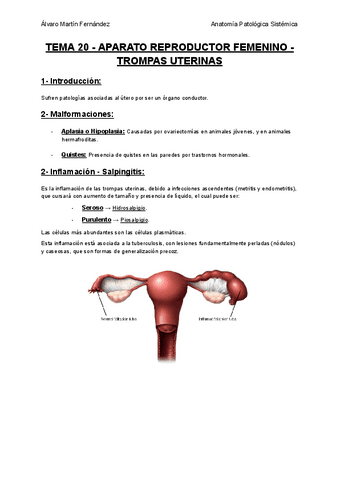 TEMA-20-APARATO-REPRODUCTOR-FEMENINO-TROMPAS-UTERINAS.pdf