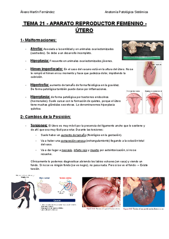 TEMA-21-APARATO-REPRODUCTOR-FEMENINO-UTERO.pdf