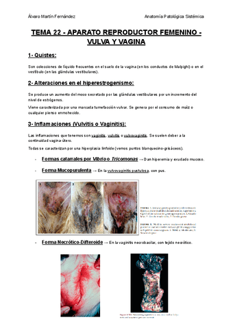 TEMA-22-APARATO-REPRODUCTOR-FEMENINO-VULVA-Y-VAGINA.pdf