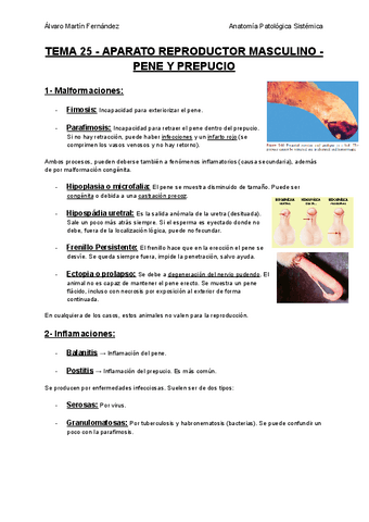TEMA-25-APARATO-REPRODUCTOR-MASCULINO-PENE-Y-PREPUCIO.pdf