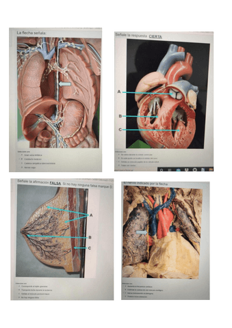 Esxamen-parcial-torax.pdf