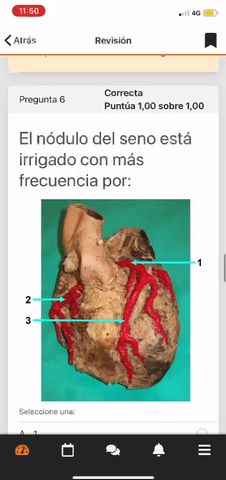 EXAMEN-PARCIAL-TORAX.MP4