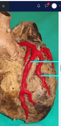 EXAMEN-PARCIAL-TORAX.MP4