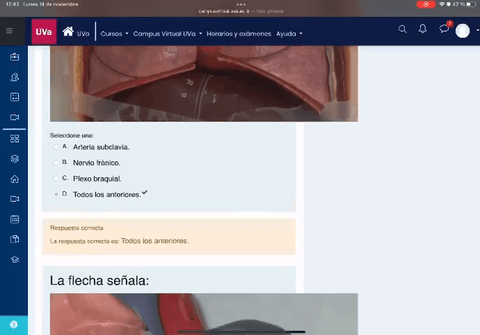 EXAMEN-PARCIAL-TORAX.MP4