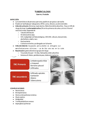 TUBERCULOSIS.pdf