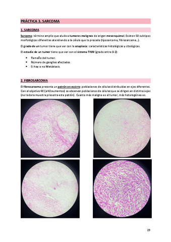 3. Sarcoma.pdf