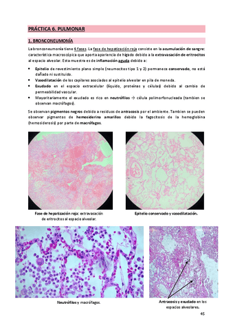 6. Pulmonar.pdf