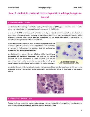 Tema-4-GINE.pdf