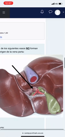 EXAMEN-1-ABDOMEN.mp4