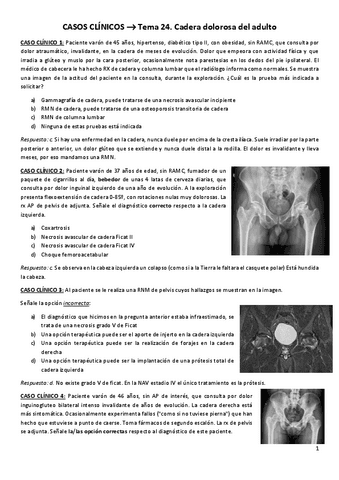 CASOS-CLINICOS-Tema-24.-Cadera-dolorosa-del-adulto.pdf